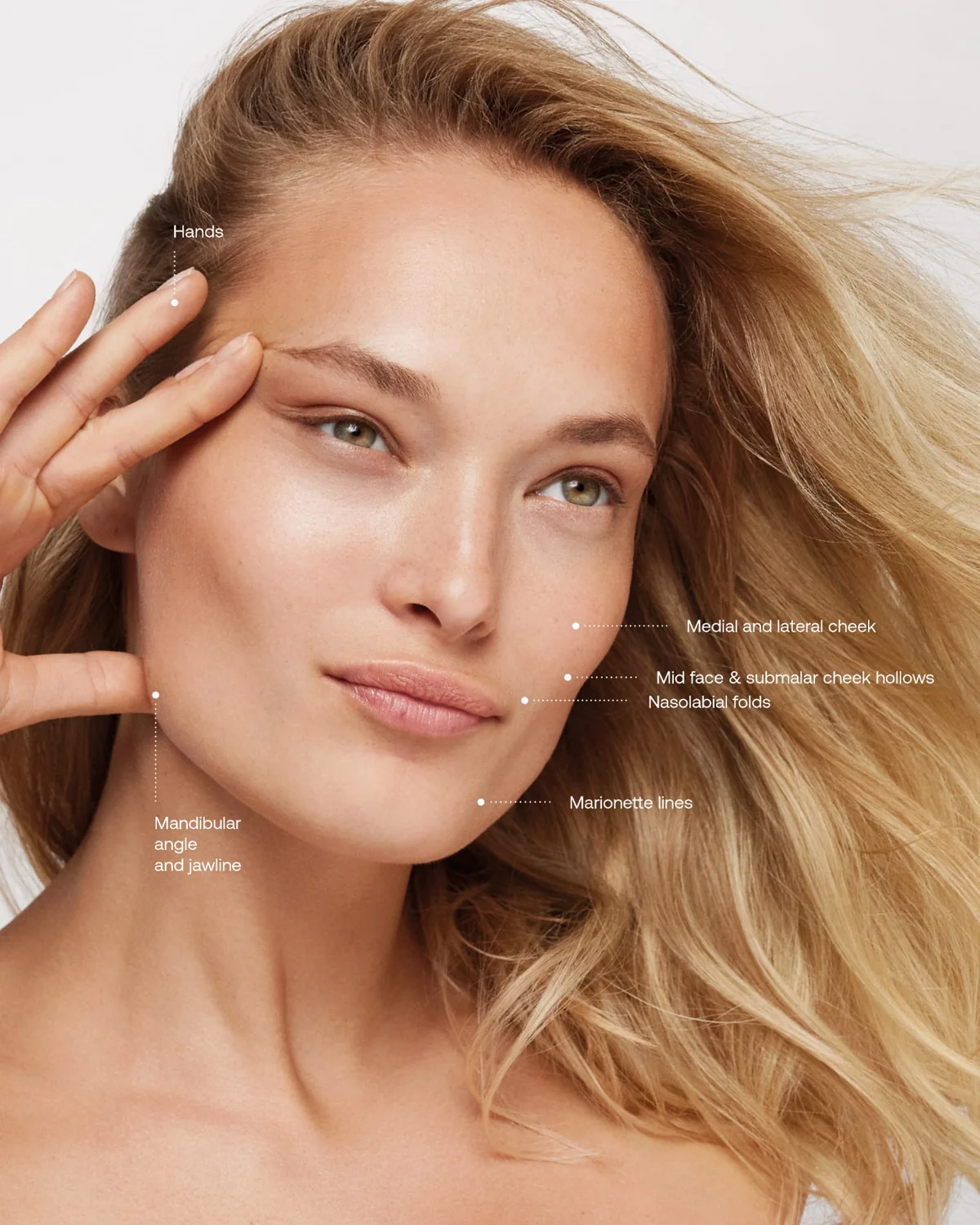 Radiesse at HADA Aesthetics, Leigh-on-Sea & Essex